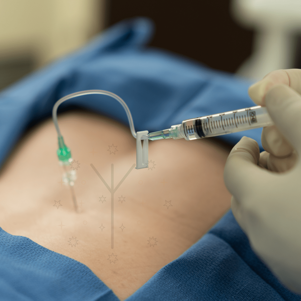 HOW TO HAVE A BLISSFUL BIRTH PREVENTING THE USE OF&nbsp;EPIDURAL